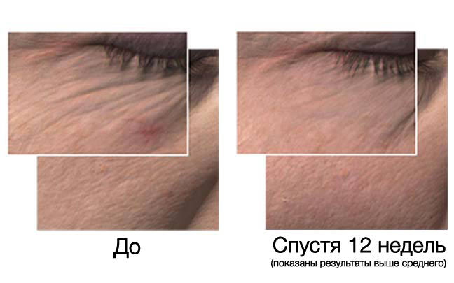 Система по уходу за кожей лица timewise для комбинированной и жирной кожи thumbnail